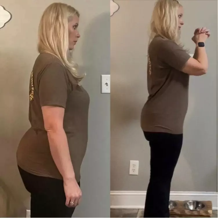 Lisa M. before and after SlimTide